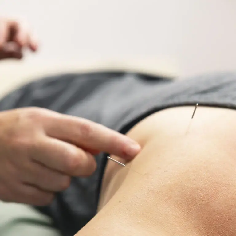Shoulder acupuncture, beaconsfield