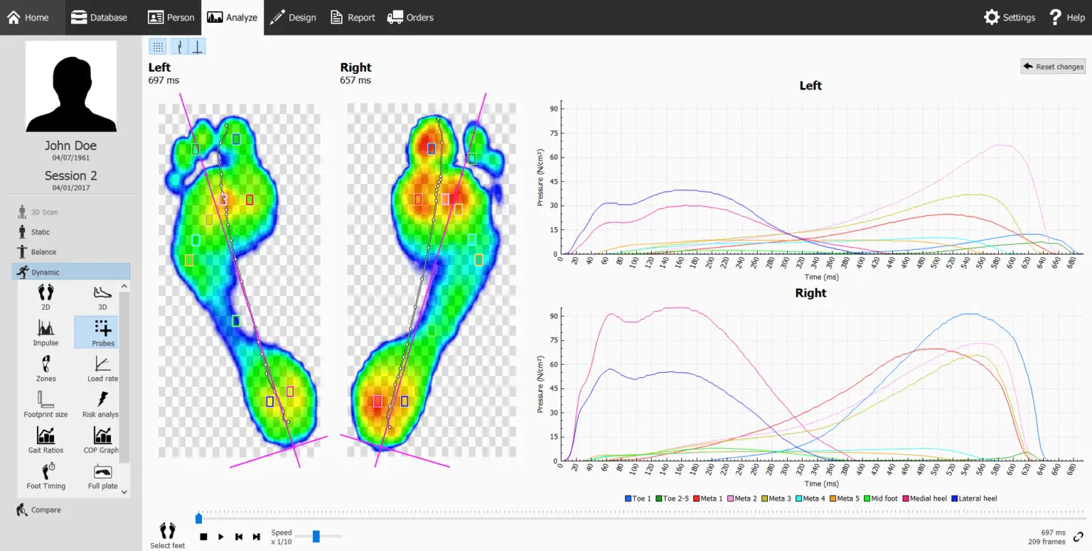 Bespoke Orthotics, custom orthotics, phits orthotics, gait scan data, beaconsfield